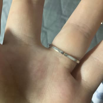 Yüzük Küçültme İşlemi Nedeniyle Garanti Dışında Kalan Ürün Mağduriyeti