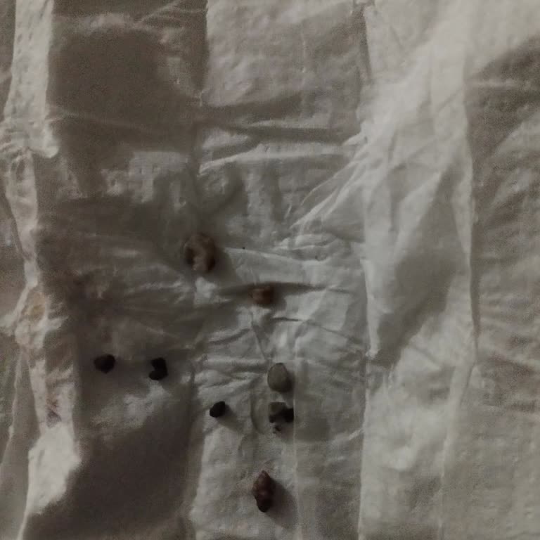 Dondurma İçinden Çıkan Sert Parçalar Dişime Zarar Verdi