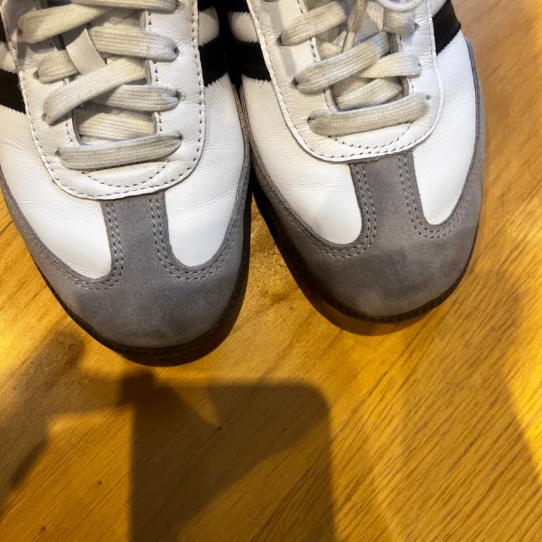 Adidas Samba Ayakkabıda Renk Değişimi Ve Garanti Sorunu