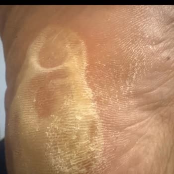 Kısa Sürede Deforme Olan Ayakkabı İçin Ret Ve İade Sorunu