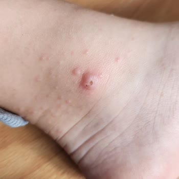 Çocuk Havuzunda Hijyen Skandalı: Sağlığımız Tehlikeye Girdi