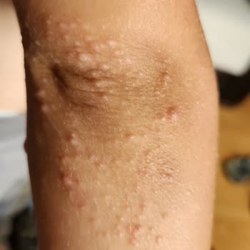 Çocuk Havuzunda Hijyen Skandalı: Sağlığımız Tehlikeye Girdi