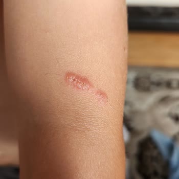 Çocuk Havuzunda Hijyen Skandalı: Sağlığımız Tehlikeye Girdi