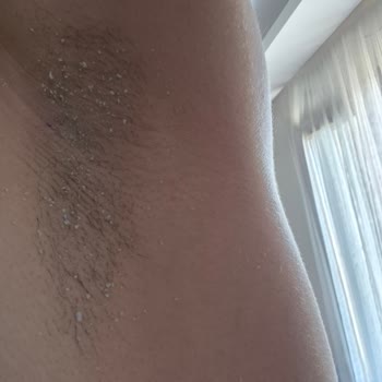 Kullanımda Dağılan Ve Etkisiz Ürün Nedeniyle İade Talebi