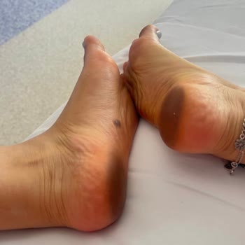 FLO'dan Aldığım Terlik Ve Sandaletlerde Renk Değişimi Ve Olumsuz İade Deneyimi