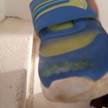 Ayakkabı Arızası Ve 4 Ay Süren İlgisizlik Mağduriyeti