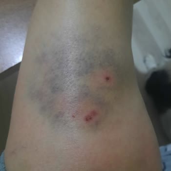 Köpek Saldırıları Ve Güvenlik Zafiyeti!