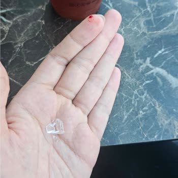 Bozuk Sütlü Kahve Nedeniyle Sağlık Sorunu Yaşadım, İlgisizlik Mağdur Etti