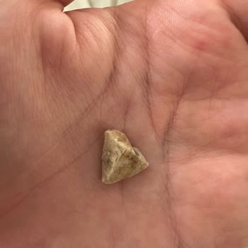 Nuga Bar İçinden Sert Cisim Çıkması Sağlık Riski Oluşturdu