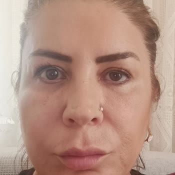 Dr. Veysel Durak Botoks Sonrası Göz Kapağında Düşüklük Ve Yetersiz Çözüm