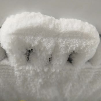 Derin Dondurucuda Sürekli Karlanma ve Yetersiz Servis Deneyimi