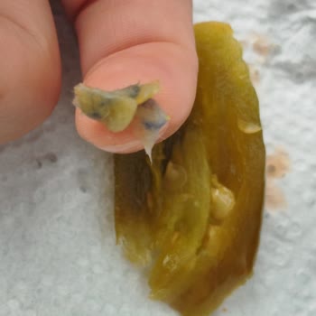 A101'den Aldığım Biber Turşusunda Yabancı Cisim Çıktı, Sağlığım Ve Güvenim Sarsıldı