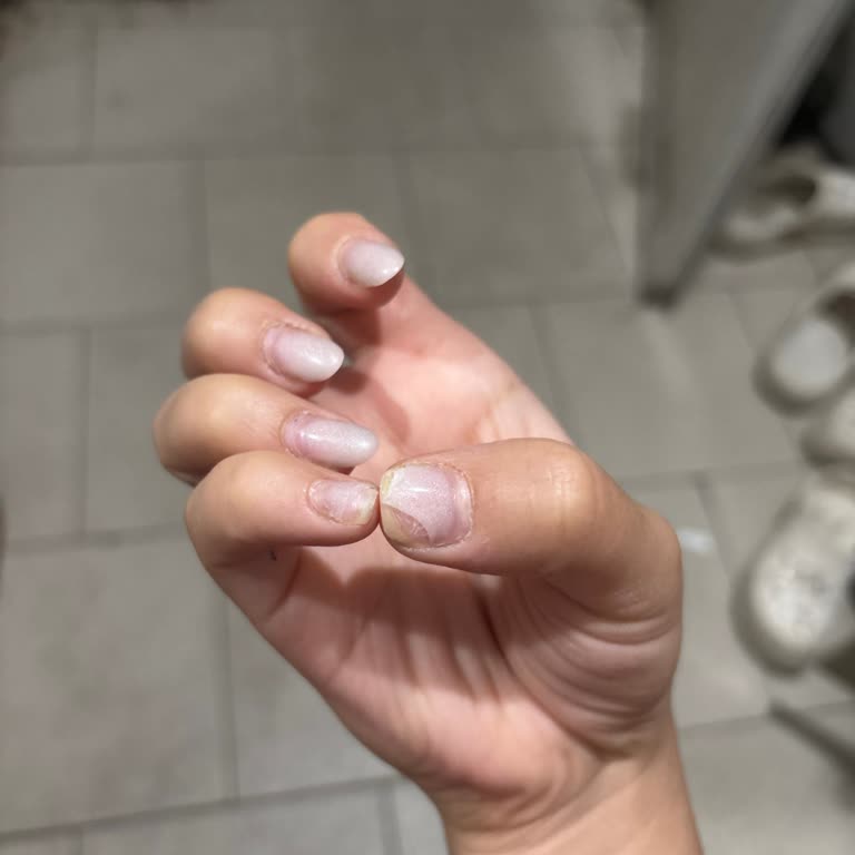 Bymomonde Beauty 13 Gün Sonra Tırnağım Kırıldı