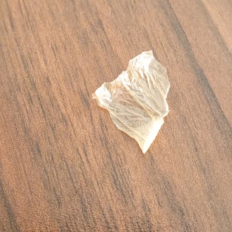 Mantıdan Çıkan Yabancı Madde Çocuğumun Sağlığını Tehdit Etti