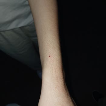 Acil Serviste Damar Yolu Açma Sürecinde Yaşanan Sorun Ve Mağduriyet