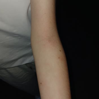 Acil Serviste Damar Yolu Açma Sürecinde Yaşanan Sorun Ve Mağduriyet