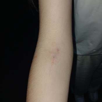 Acil Serviste Damar Yolu Açma Sürecinde Yaşanan Sorun Ve Mağduriyet