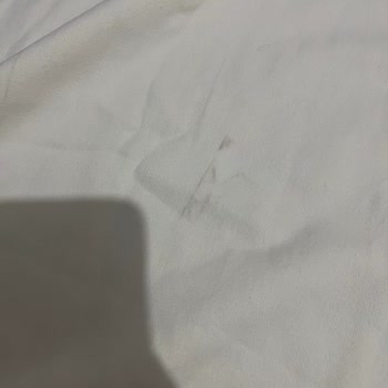 Defolu Ürün Ve Saygısız Müşteri Hizmeti Nedeniyle İade Sorunu