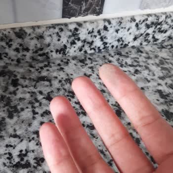 Eleman Yönlendir Temizlik Hizmetinde Eksiklik Ve Mağduriyet