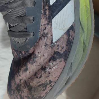 Adidas Ayakkabıda Amblem Yırtılması Ve Garanti Sorunu