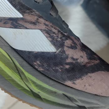 Adidas Ayakkabıda Amblem Yırtılması Ve Garanti Sorunu