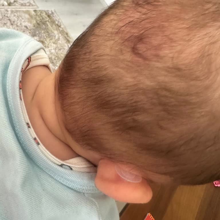 Yapışkan Ürün Sorunu Ve İade Talebine Yanıt Alınamıyor