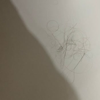 Hijyen Ve Güvenlik Sorunları Nedeniyle Hayal Kırıklığı Yaratan Tatil Deneyimi