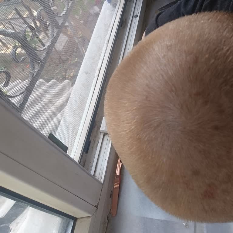 Saç Boyası Kullanımı Sonrası Ağrılı Deri Sorunları