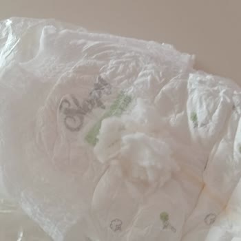 Bebek Bezi Kaynaklı Cilt Sorunları: Sağlık Ve Güven Endişesi