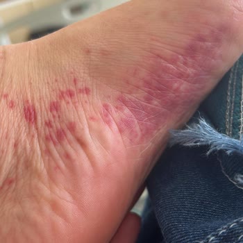 Sivas Cumhuriyet Üniversitesi Hastanesi'nde Yetersiz İlgi ve Tedavi Sürecinde Aksaklık