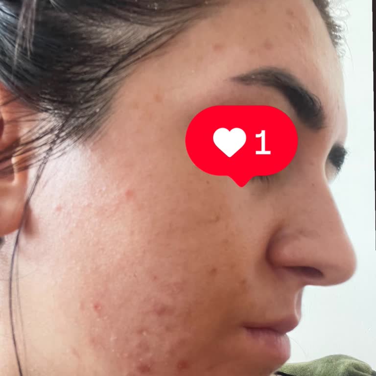 Trendyol'dan Satın Aldığım La Roche Posay Güneş Kremlerinin Sahte Çıkması Ve Mağduriyetim