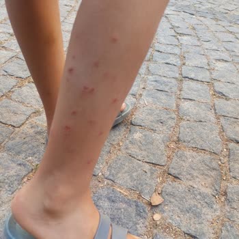 Şahinler Mobilya (Bergama) Mağduriyeti