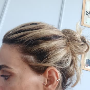 Yüksek Ücret, Kötü Sonuç: Saçım Mahvoldu, Ücret İadesi İstiyorum