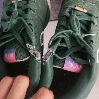 Yeni Alınan Ayakkabının Kısa Sürede Açılması Ve İade Talebinin Reddedilmesi Mağduriyet Yarattı