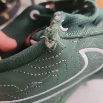 Yeni Alınan Ayakkabının Kısa Sürede Açılması Ve İade Talebinin Reddedilmesi Mağduriyet Yarattı