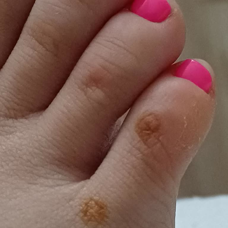 Hotiç'ten Aldığım Ürünlerde Kısa Sürede Ciddi Kalite Sorunları Yaşadım