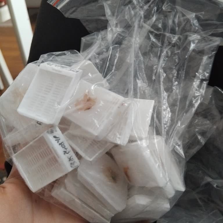 Ege Üniversitesi Hastanesi Patoloji Laboratuvarı’nda İhmal