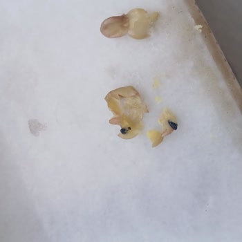 Duru Yeşil Mercimekten Her Defasında Böcek Çıkıyor!