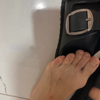 İlk Kullanımda Ciddi Rahatsızlık Veren Terlik İçin İade Talebi