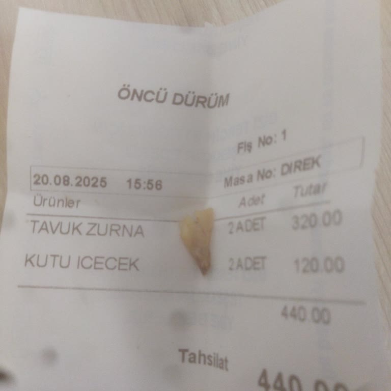 Zurna Dürümde Kemik Çıkması Sağlığımızı Tehlikeye Attı