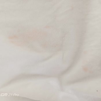 Bosch Çamaşır Makinesi Leke Çıkarma Sorunu Ve Yetersiz Servis Desteği