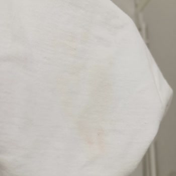 Bosch Çamaşır Makinesi Leke Çıkarma Sorunu Ve Yetersiz Servis Desteği