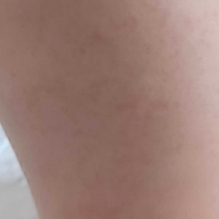 Kargo Teslimatında Kırık Ürün Ve Ücret İadesi Talebi