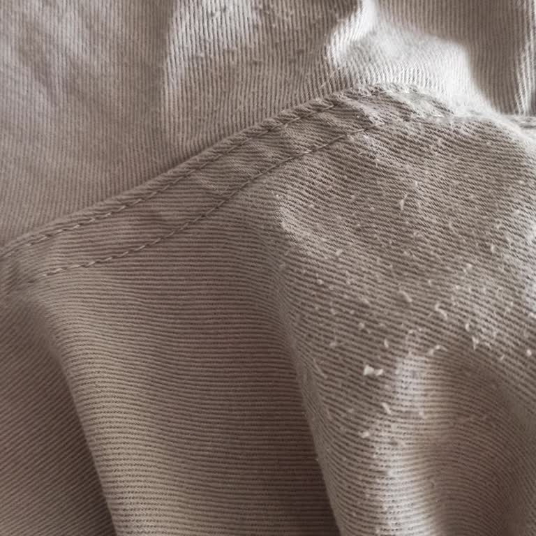 Aldığım Şort Kısa Sürede Toz Topladı Ve İade Talebim Var