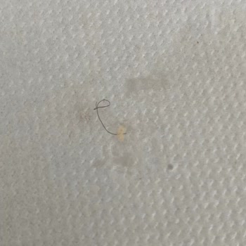 Siparişimde Hijyen Sorunu Ve Yetersiz Destek: Dönerde Kıl Ve Aşırı Yağ