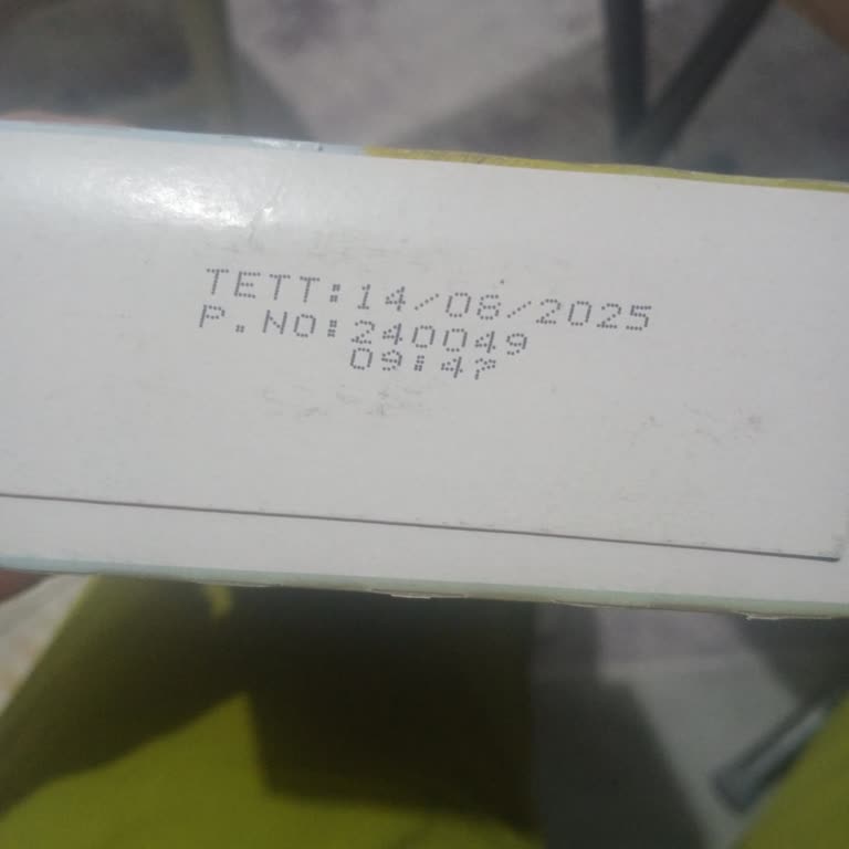 A101'den Son Kullanma Tarihi Geçmiş Ürün Satışı Nedeniyle Güvenlik Endişesi