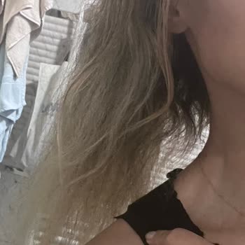 Kuaför Hatası Sonucu Saçlarım Yandı Ve Geri Dönülmez Zarar Gördüm