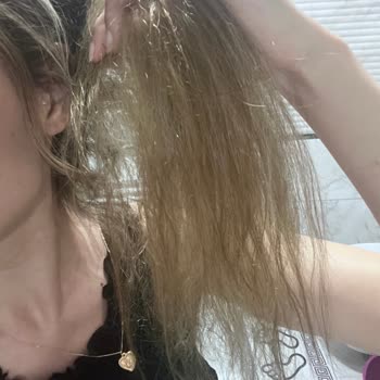 Kuaför Hatası Sonucu Saçlarım Yandı Ve Geri Dönülmez Zarar Gördüm