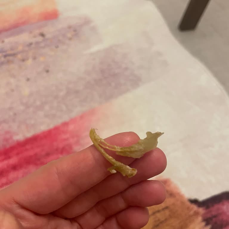 Hamburgerin İçinden Çıkan Yabancı Cisimle Boğulma Tehlikesi Yaşadım