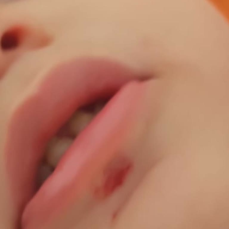 Acil Serviste Yetersiz Müdahaleye Orantısız Ücret Alındı